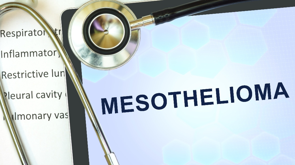 Tablet with word Mesothelioma and stethoscope